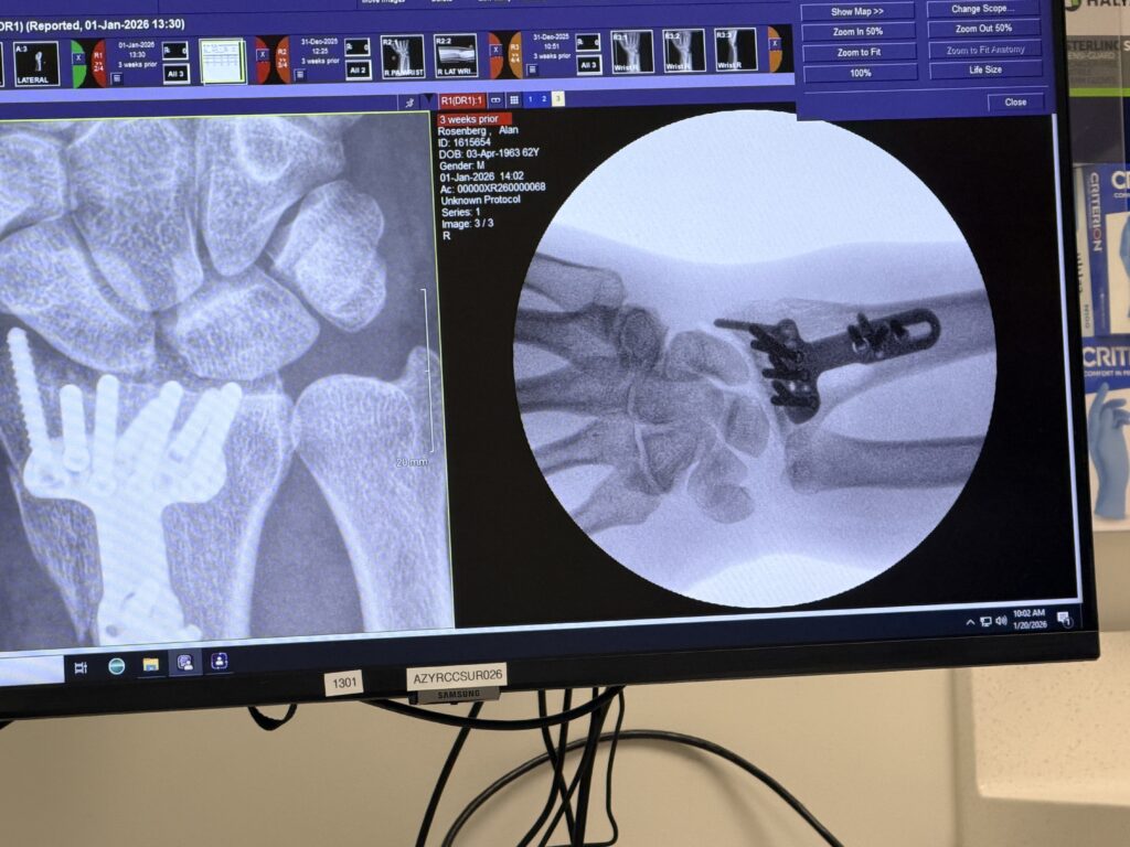 After surgery